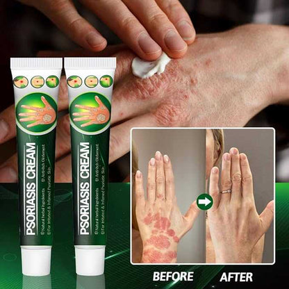 Psoriasis Cream 20g | Soothing & Hydrating Skin Relief Formula – 100% Original